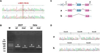 Genetic analysis and prenatal diagnosis of short-rib thoracic dysplasia 3 with or without polydactyly caused by compound heterozygous variants of DYNC2H1 gene in four Chinese families